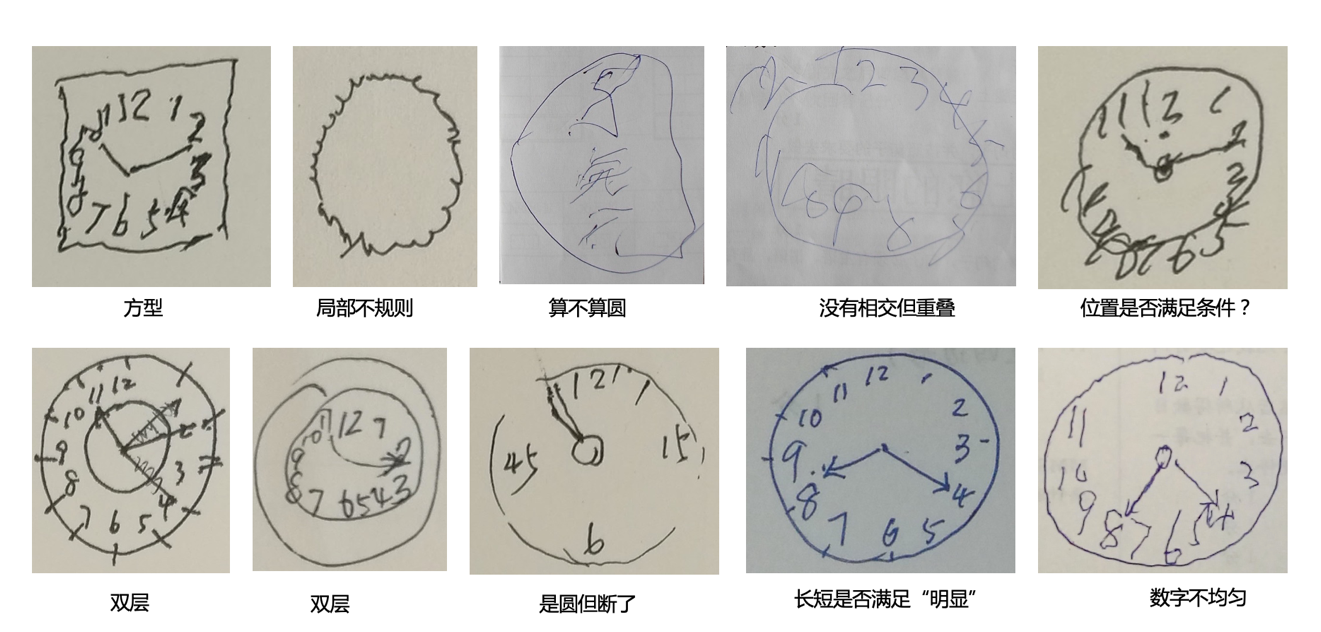 国际医学杂志《柳叶刀》研究表明阿尔茨海默病患者高达983万人 首个AI筛查小程序上线