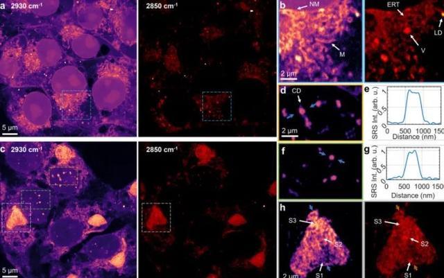 科学家用AI开发受激拉曼纳米成像技术,分辨率可达86纳米